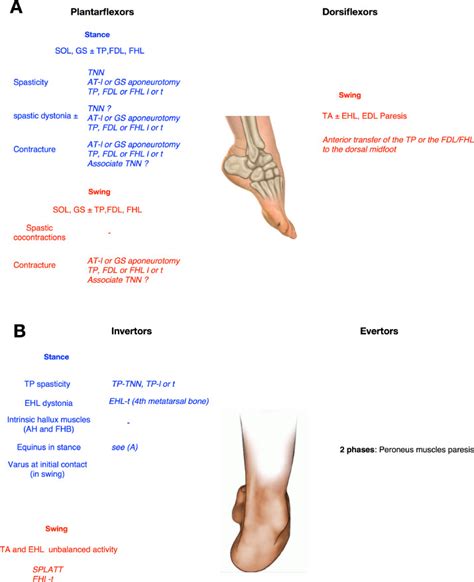 Neuro Orthopedic Surgery For Equinovarus Foot Deformity In Adults A