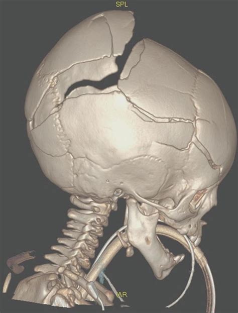 Fig 7 1 Volume Rendering Technique VRT Obtained Diseases