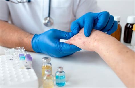 👍Рейтинг лучших средств и лекарств от чесотки в 2025 году