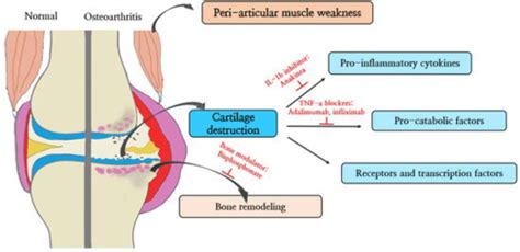 Osteoarthritis Flashcards Quizlet