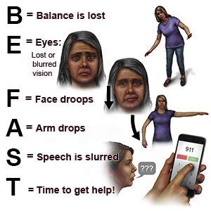 Right Hemispheric Stroke - What You Need to Know