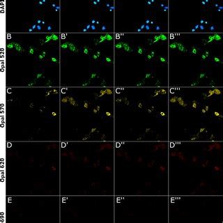 Spectral Unmixing Of Smfish Data From Cultured Mouse Neurons Neuronal