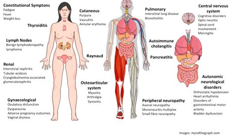 Ijms Free Full Text Neurological And Inflammatory Manifestations In