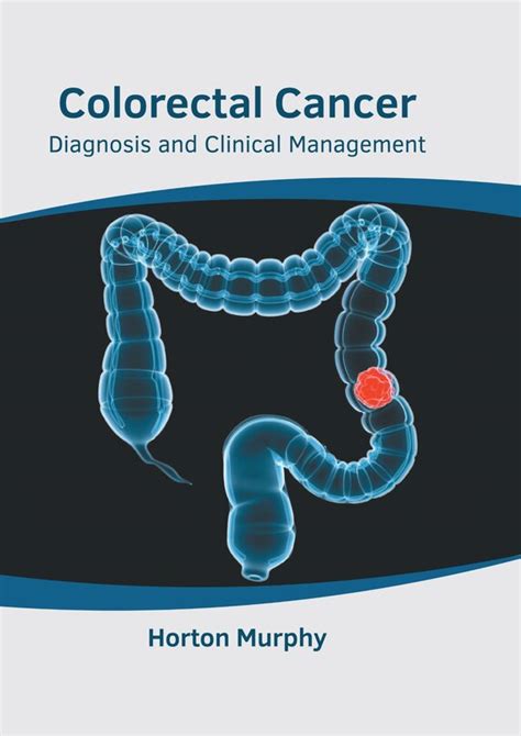 Colorectal Cancer: Diagnosis and Clinical Management | Indigo