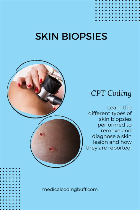 Skin Biopsy Coding Cpt To Diagnose A Skin Lesion Artofit