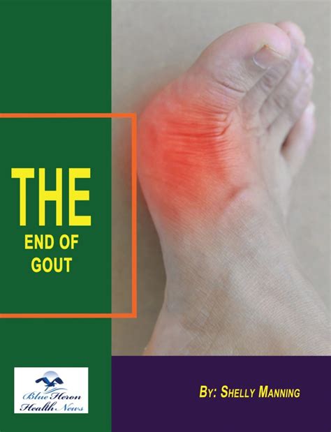 What Tests Are Used To Diagnose Gout Blue Heron Health News