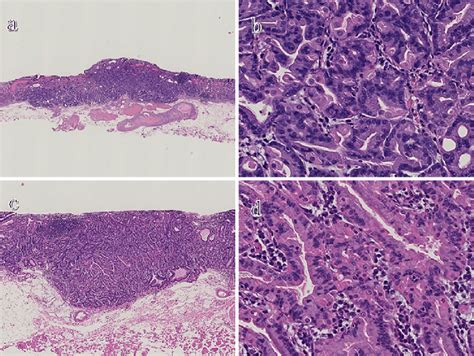 Figure3 A Histological Examination Of The Resected Specimens