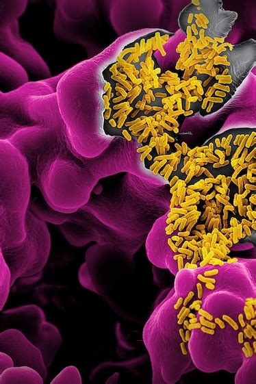 How trillions of microbes affect every stage of our life—from birth to ... 