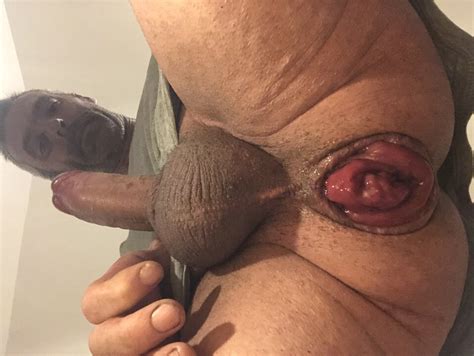 I Was In A Hurry To Masturbate By Showing You My Anal Prolapse XHamster