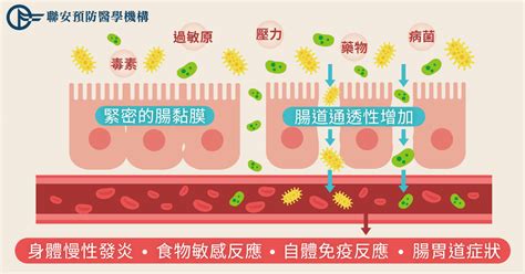 7歲男童長期便秘治不好，原因在沒修復腸黏膜！ 良醫健康網