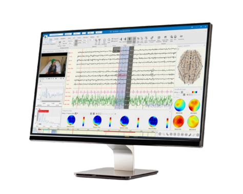 Brain Quick Ltm Eeg System Long Term Video Eeg Monitoring Natus