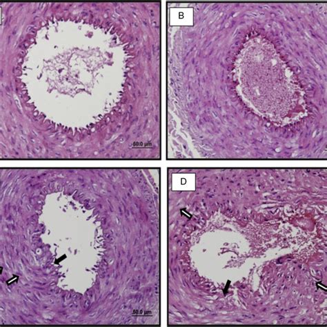 Representative Light Microscopic Images Of H E Staining In Vascular