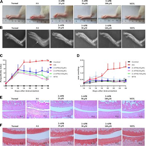 Frontiers Blockade Of Trpm Alleviates Chondrocyte Apoptosis And