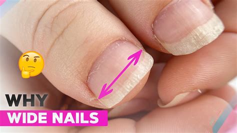 Wide Nails On The Thumbs Gel Nail Correction Soft Floral Nail Art