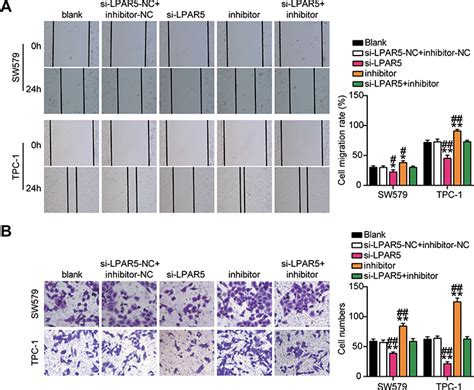 Tnrc6c As1 Promotes Thca Progression By Upregulating Lpar5 Cmar