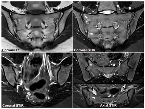 Jcm Free Full Text Diagnostics Of Sacroiliac Joint Differentials To