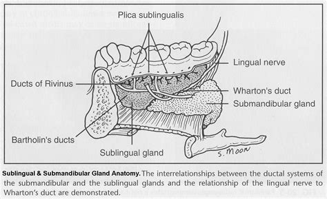 Sublingual Gland Removal – Exodontia