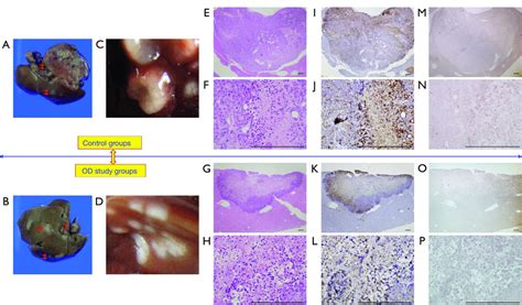 Intraportal Oridonin Inhibits Tumor Growth In Hemispleen Models Scale