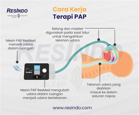 Cara Kerja Terapi Pap Resindo Medika