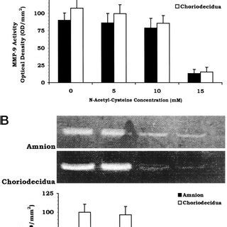 Effect Of NAC On LPS Stimulated MMP 9 Enzyme Activity A And UPA