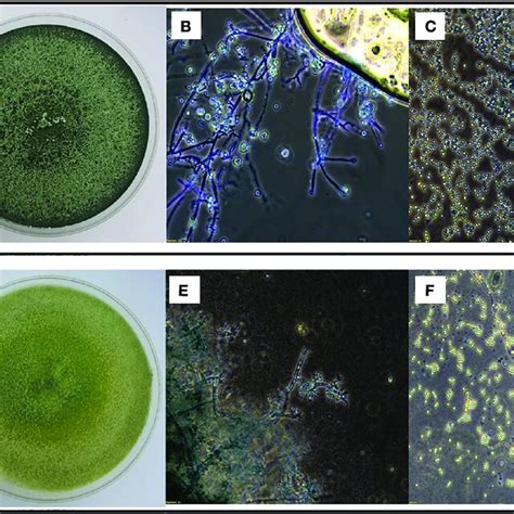 Morphological Characterization Of Indigenous Trichoderma Asperelloides