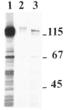 Figure From Sialylation Of The B Lymphocyte Molecule Cd By Alpha