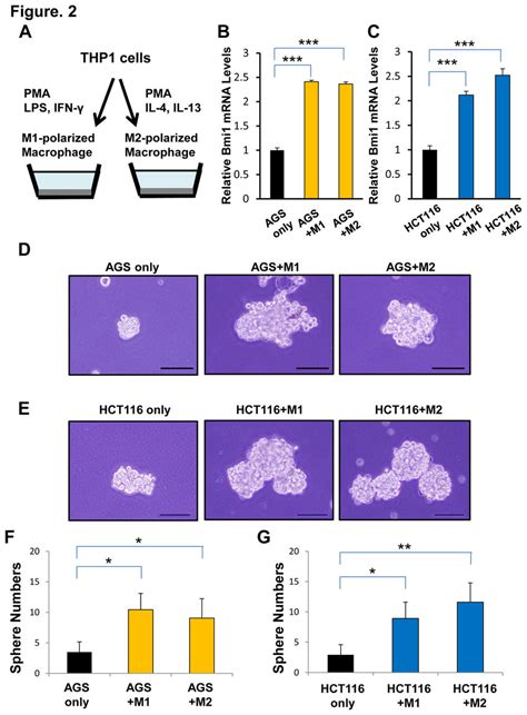 Bmi1 Expression And Sphere Assay In Gastrointestinal Cancer Cell Lines