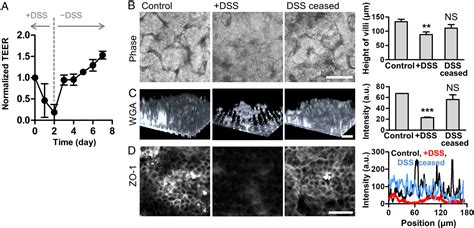 Pdf Intestinal Barrier Dysfunction Orchestrates The Onset Of