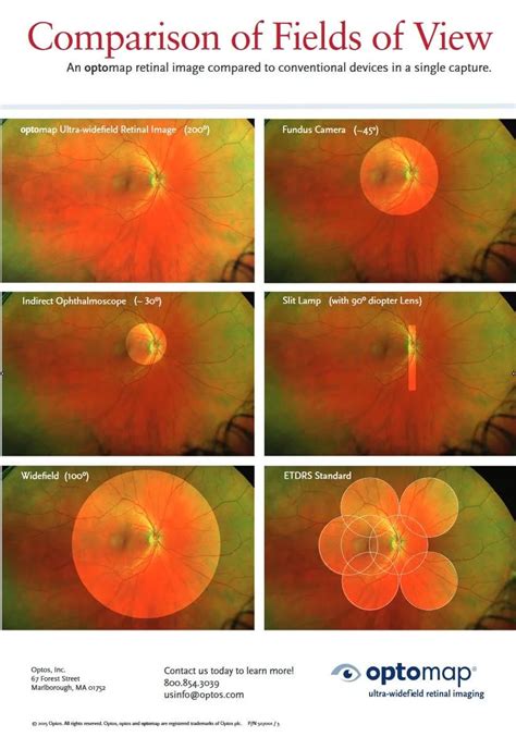 Wide Field Retinal Imaging Optometrist In Fall River Ma Fall River