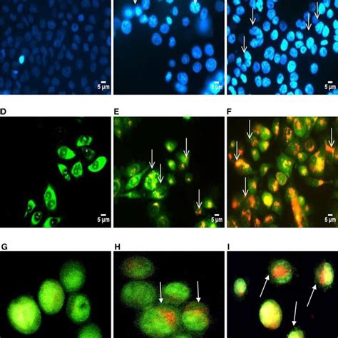 Pro Apoptotic Effect Of Asc S On Hela Cells A Dapi Stained Control