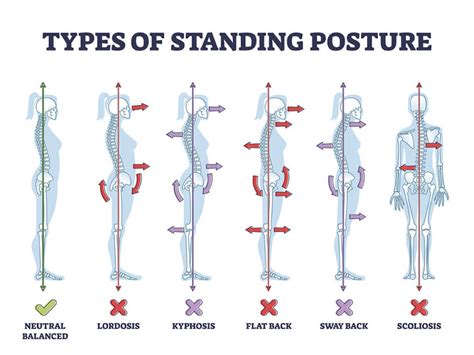 Why We Should Care About Posture Vector Health