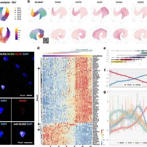 Wm Microglia Appear More Advanced In Age Than Gm Microglia Are Download Scientific Diagram