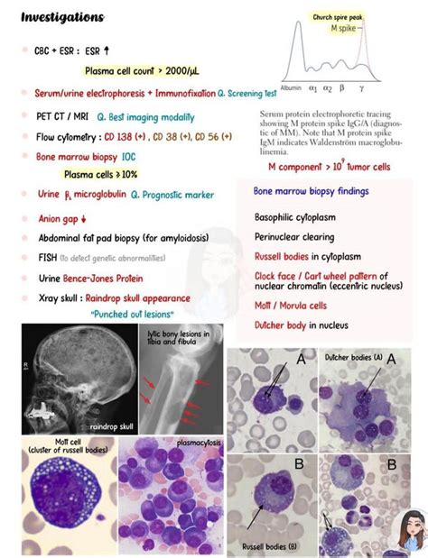 Multiple Myeloma Iii Medizzy