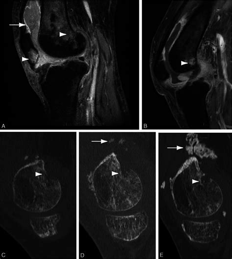 Magnetic Resonance Imaging MRI And Computed Tomography CT Scans Of