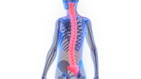 Spinal Shock: Causes, Symptoms, Diagnosis & Treatment - HealthPulls