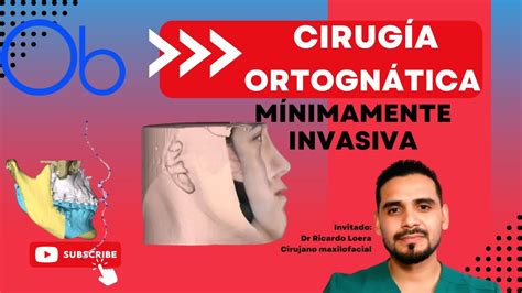 Cirug A Ortogn Tica M Nimamente Invasiva Con Dr Ricardo Loera Youtube