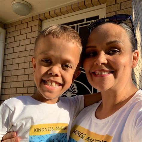 Quaden Bayles The Boy Bullied Because Of His Dwarfism Cast In New