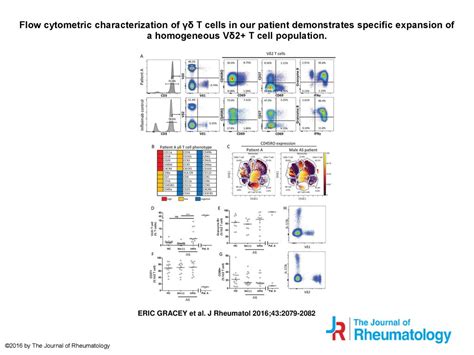 Flow Cytometric Characterization Of T Cells In Our Patient