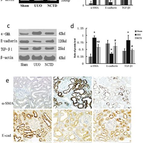 Tgf B1 Induces The Expression Of A Sma In Hk 2 Cells A And B