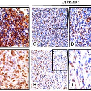 Immunohistochemical Staining For Pcna A D And Ki F And I