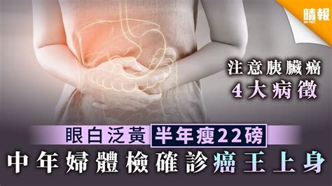 【胰臟癌】眼白泛黃半年瘦22磅 中年婦體檢確診癌王上身【內附4大症狀】 晴報 健康 腸胃保健 D200901