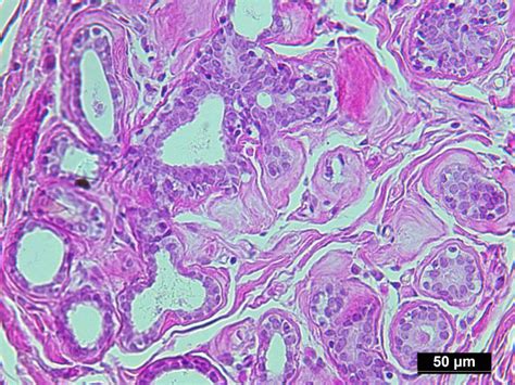 Pure Human Normal Mammary Gland Epithelial Cells Isolated By Lcm From