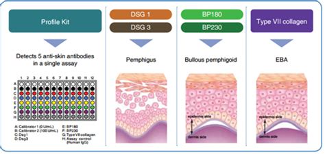 Differential Diagnosis of Pemphigus – Caltag Medsystems