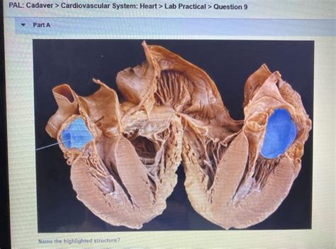 Solved Pal Cadaver Cardiovascular System Heart Lab Chegg