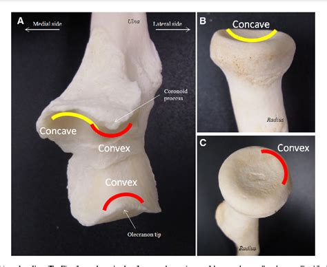 Structure of coronoid process of ulna | Semantic Scholar