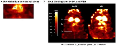 Frontiers Intranasal Dopamine Reduces In Vivo 123i Fp Cit Binding To