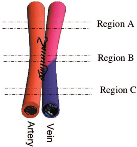 Tissue Preparation Diagrammatic Representation Of The Arteriovenous