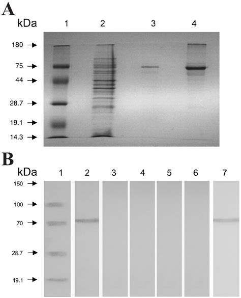 A Separation By Sodium Dodecyl Sulfate Polyacrylamide Gel