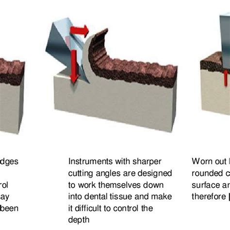 Carisolv Gel Multimix And Hand Instruments Download Scientific Diagram