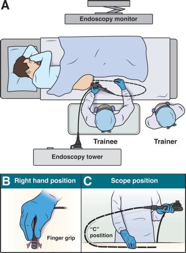 Integrating Ergonomics Into Endoscopy Training A Guide For Faculty And